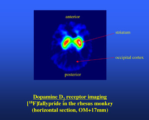 An PET scan image of a
rhesus brain