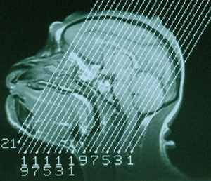 An MRI of a rhesus
monkey cranium 